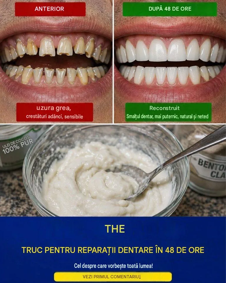 Adâncituri la linia gingiilor: cauze, tratamentul dinților sensibili și cum să-ți protejezi zâmbetul