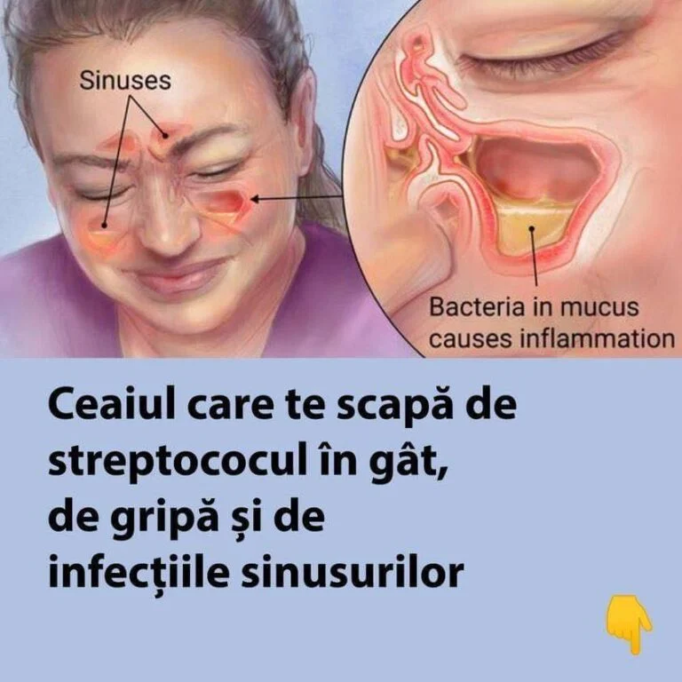Ceaiul care te scapă de streptococul în gât, de gripă și de infecțiile sinusurilor – Cum se prepară