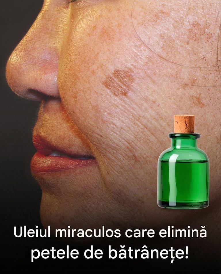 Uleiul miraculos care elimină petele de vârstă!