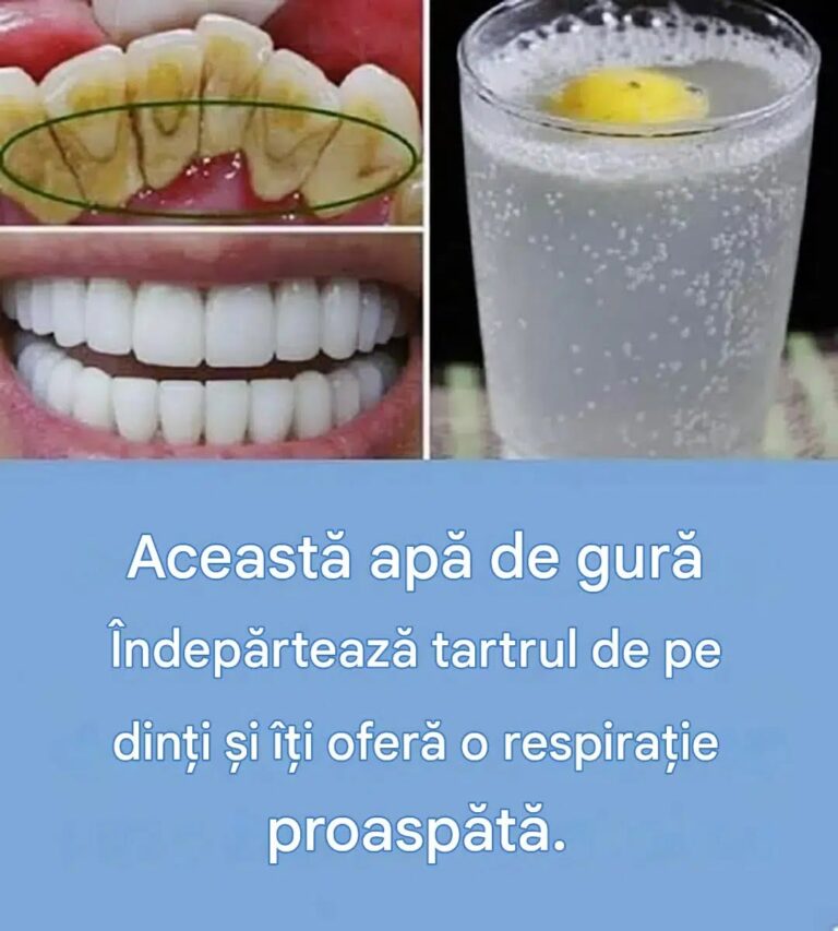 O metodă naturală de îndepărtare a tartrului dentar