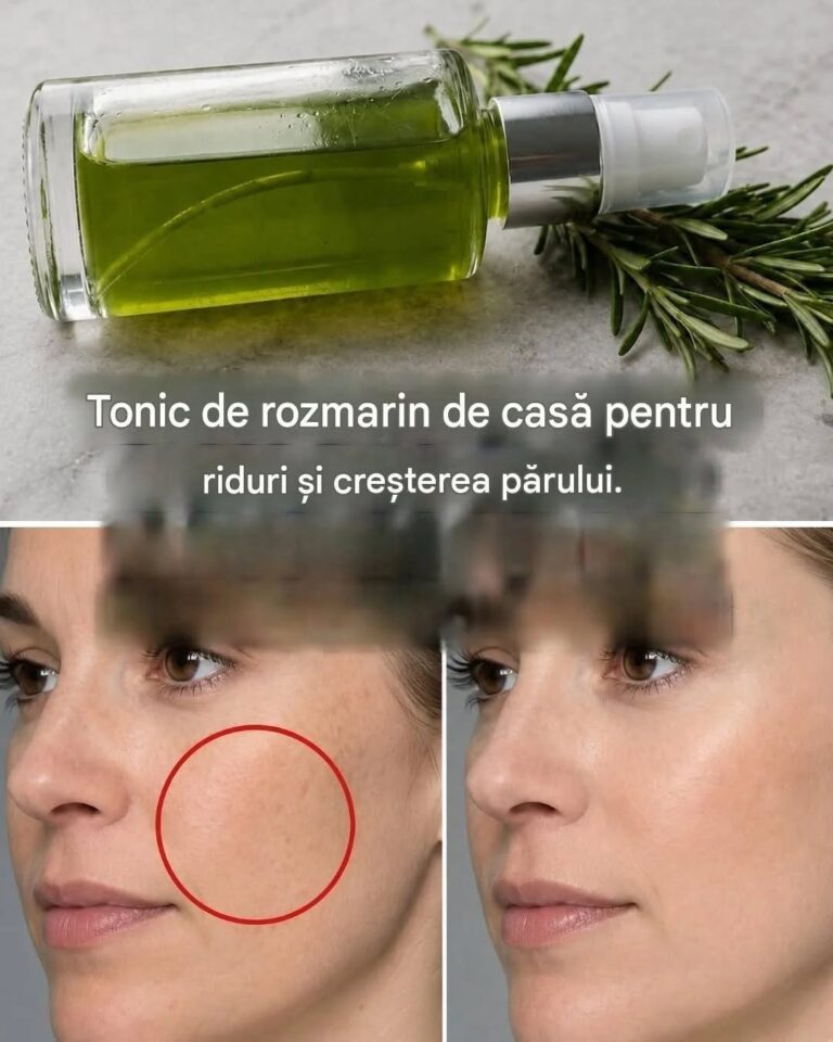 Tonic cu rozmarin pentru riduri și impurități ale pielii. Continuare în comentarii