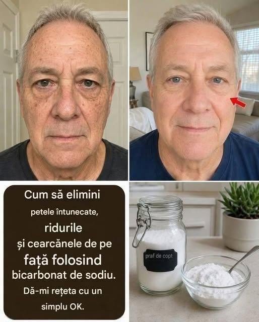 Bicarbonat de sodiu pentru față: calmant, neiritant și sigur de utilizat (mai mult de 4 rețete blânde).